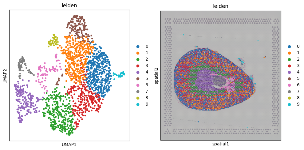 ../_images/notebooks_kidney_demo_22_0.png