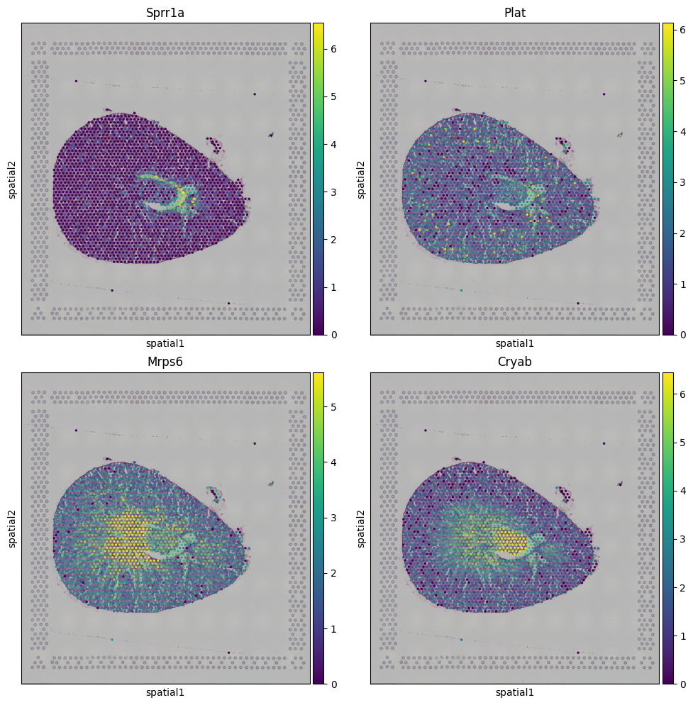 ../_images/notebooks_kidney_demo_27_0.png